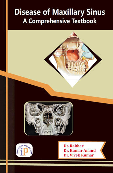 Disease of Maxillary Sinus - A Comprehensive Textbook
