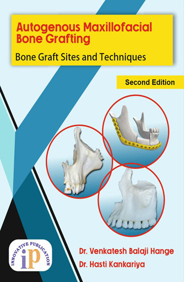 Autogenous Maxillofacial Bone Grafting: Bone Graft Sites and Techniques