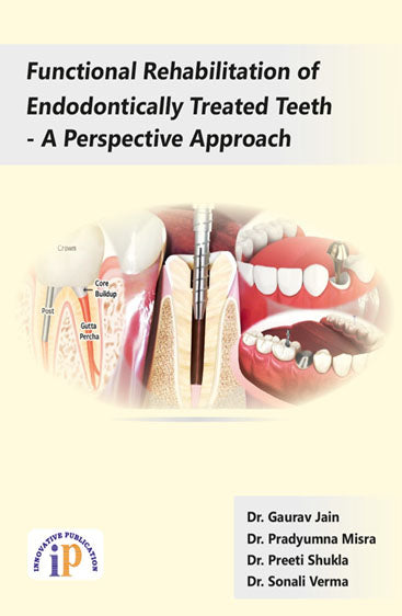 Functional Rehabilitation of Endodontically Treated Teeth - A Perspective Approach