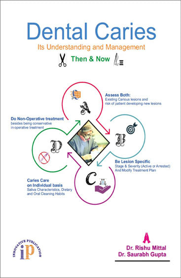 Dental Caries (Its Understanding and Management) Then & Now