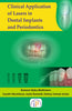 Clinical Application of Lasers in Dental Implants and Periodontics thumbnail 1