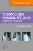 Tuberculous Pleural Effusion (A Book of 100 Cases) thumbnail 1