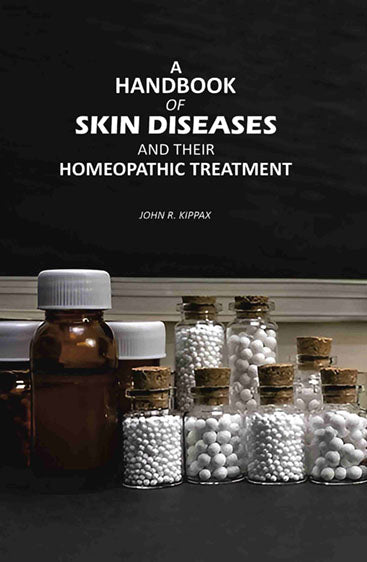A Handbook of Skin Diseases: And Their Homeopathic Treatment