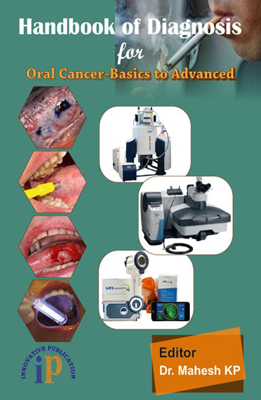 Handbook of Diagnosis for Oral Cancer-Basics to Advanced