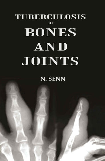 Tuberculosis of Bones and Joints