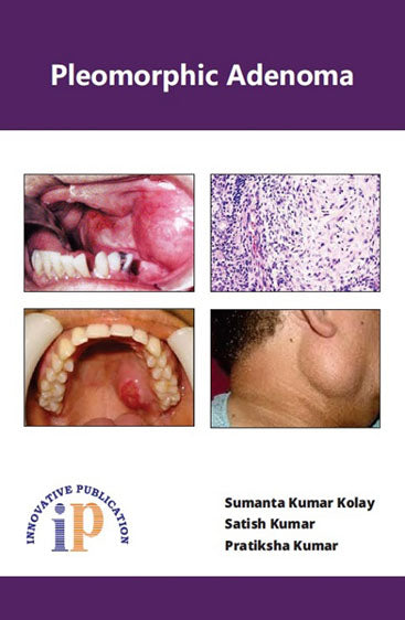 Pleomorphic Adenoma