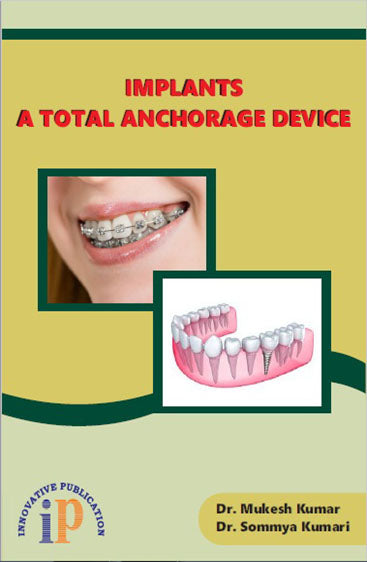 Implants - A Total Anchorage Device